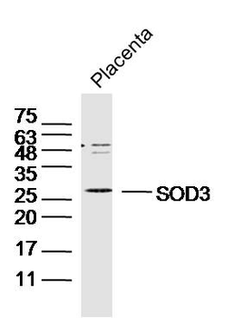 SOD3 Rabbit Polyclonal Antibody