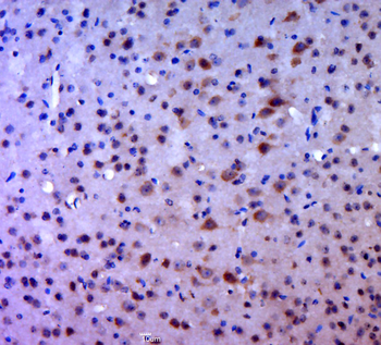SPHK1 Rabbit Polyclonal Antibody