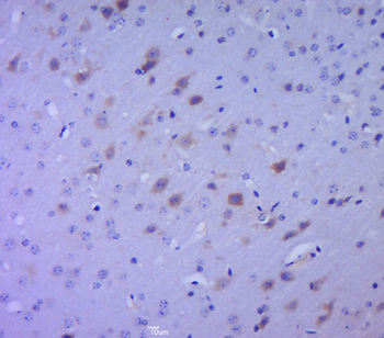 SPHK2 Rabbit Polyclonal Antibody