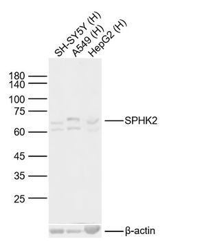SPHK2 Rabbit Polyclonal Antibody