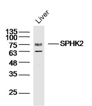SPHK2 Rabbit Polyclonal Antibody