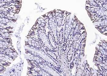 Phospho-Src (Tyr418) Rabbit Polyclonal Antibody