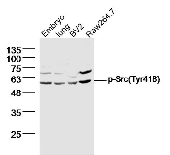 Phospho-Src (Tyr418) Rabbit Polyclonal Antibody