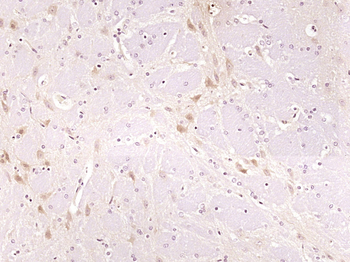 Synaptopodin Rabbit Polyclonal Antibody