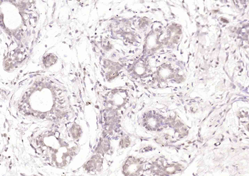 STAT5b Rabbit Polyclonal Antibody
