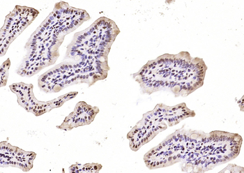 Phospho-Stat4 (Tyr693) Rabbit Polyclonal Antibody