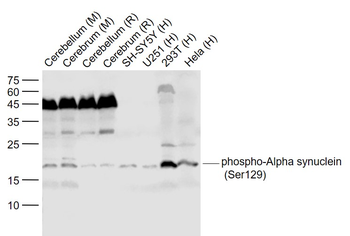 Phospho-Alpha synuclein (Ser129) Rabbit Polyclonal Antibody