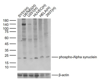 Phospho-Alpha synuclein (Ser129) Rabbit Polyclonal Antibody