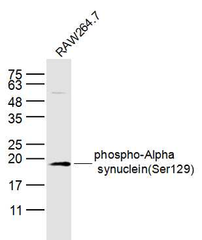 Phospho-Alpha synuclein (Ser129) Rabbit Polyclonal Antibody