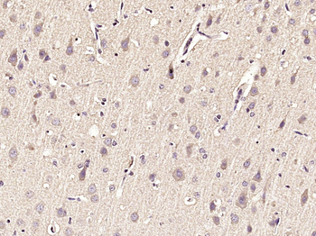 Synapsin 1 Rabbit Polyclonal Antibody