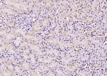 HMGB1 Rabbit Polyclonal Antibody