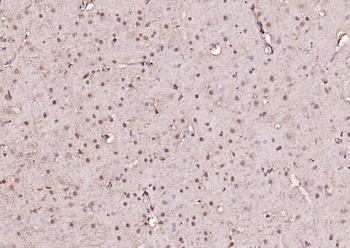 HMGB1 Rabbit Polyclonal Antibody