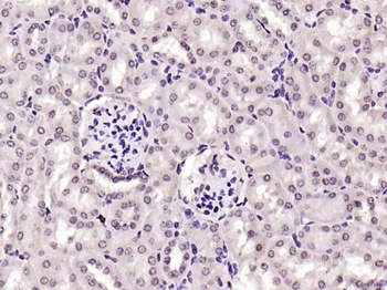 BLM Rabbit Polyclonal Antibody