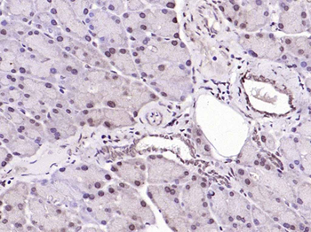 BLM Rabbit Polyclonal Antibody