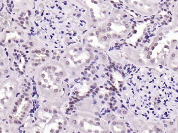 BLM Rabbit Polyclonal Antibody