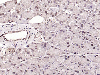 BLM Rabbit Polyclonal Antibody