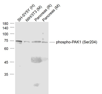 Phospho-PAK1 (Ser204) Rabbit Polyclonal Antibody