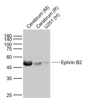 Ephrin B2 Recombinant Rabbit Monoclonal Antibody