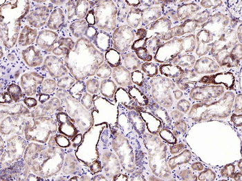 Cytochrome P450 17A1 Recombinant Rabbit Monoclonal Antibody
