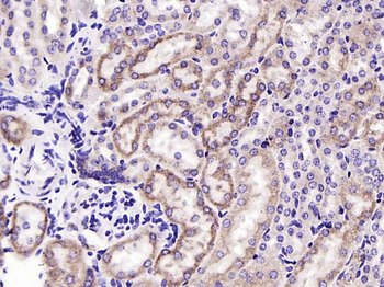 Cytochrome P450 17A1 Recombinant Rabbit Monoclonal Antibody