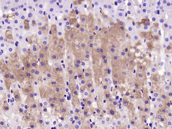 Cytochrome P450 17A1 Recombinant Rabbit Monoclonal Antibody