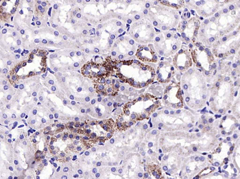 Cytochrome P450 17A1 Recombinant Rabbit Monoclonal Antibody