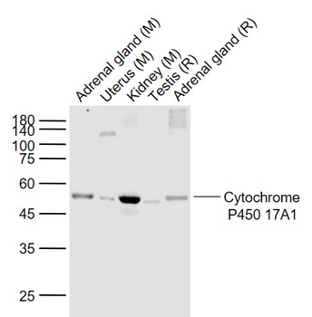 Cytochrome P450 17A1 Recombinant Rabbit Monoclonal Antibody