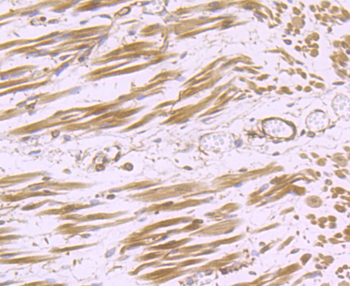 H Cadherin Recombinant Rabbit Monoclonal Antibody