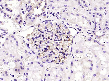 H Cadherin Recombinant Rabbit Monoclonal Antibody