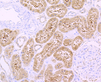 H Cadherin Recombinant Rabbit Monoclonal Antibody