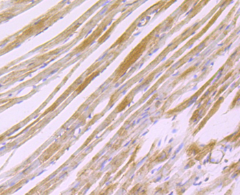 H Cadherin Recombinant Rabbit Monoclonal Antibody