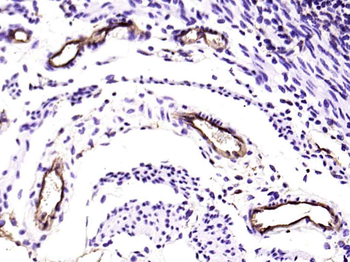 H Cadherin Recombinant Rabbit Monoclonal Antibody
