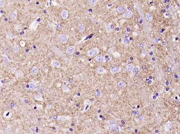 H Cadherin Recombinant Rabbit Monoclonal Antibody