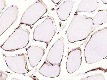 H Cadherin Recombinant Rabbit Monoclonal Antibody