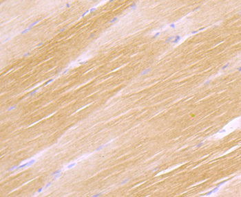 H Cadherin Recombinant Rabbit Monoclonal Antibody
