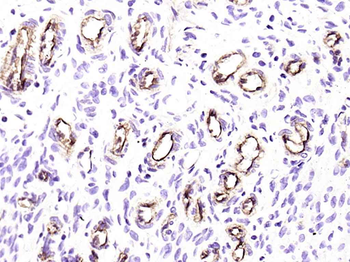 H Cadherin Recombinant Rabbit Monoclonal Antibody