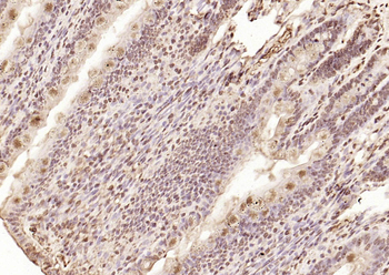 CDKN1A/p21 Rabbit Polyclonal Antibody