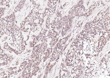 HSC70 Mouse Monoclonal Antibody
