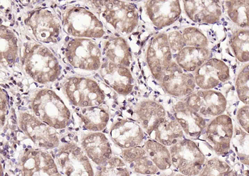 HSC70 Mouse Monoclonal Antibody