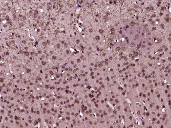 HSC70 Mouse Monoclonal Antibody