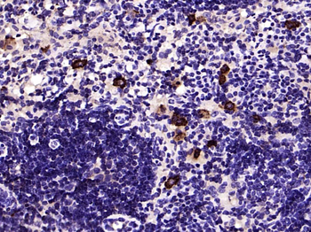 CD27 Recombinant Rabbit Monoclonal Antibody