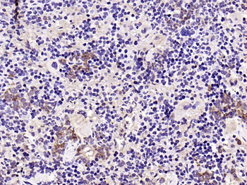 CD27 Recombinant Rabbit Monoclonal Antibody