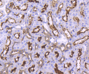 ACE2 Recombinant Rabbit Monoclonal Antibody
