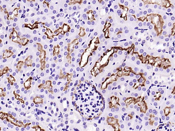 ACE2 Recombinant Rabbit Monoclonal Antibody