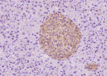 Gelsolin Recombinant Rabbit Monoclonal Antibody