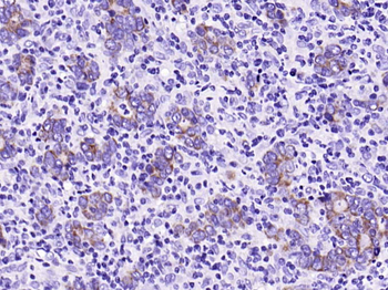 COX4I1 Recombinant Rabbit Monoclonal Antibody