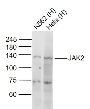 JAK2 Rabbit Polyclonal Antibody