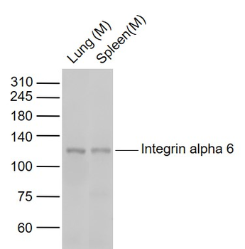 Integrin alpha 6 Recombinant Rabbit Monoclonal Antibody