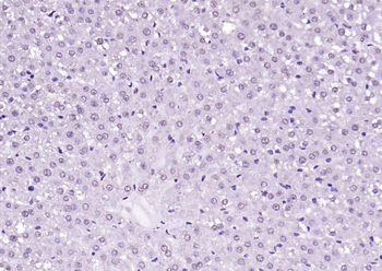 SIK1 Rabbit Polyclonal Antibody