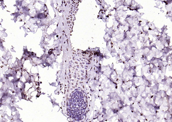 SIK1 Rabbit Polyclonal Antibody